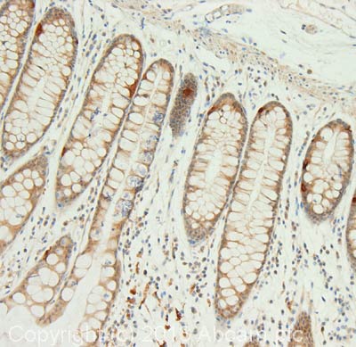 IHC image of NPSR1 staining in Human Colon formalin fixed paraffin embedded tissue section, performed on a Leica Bond system using the standard protocol F. The section was pre-treated using heat mediated antigen retrieval with sodium citrate buffer (pH6, epitope retrieval solution 1) for 20 mins. The section was then incubated with ab92425, 5µg/ml, for 15 mins at room temperature and detected using an HRP conjugated compact polymer system. DAB was used as the chromogen. The section was then counterstained with haematoxylin and mounted with DPX.