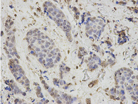 Immunohistochemical analysis of formalin fixed and paraffin embedded rat testis labeling Proteasome beta 1 with ab196623 at a 1/200 dilution.
