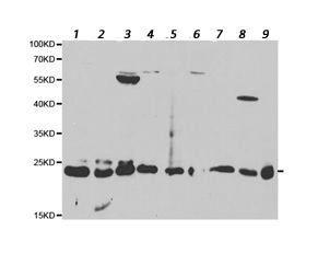 All lanes : Anti-Proteasome beta 1 antibody (ab196623) at 1/500 dilutionLane 1 : MCF7 cell extractLane 2 : HL60 cell extractLane 3 : SW480 cell extractLane 4 : HepG2 cell extractLane 5 : SW620 cell extractLane 6 : K562 cell extractLane 7 : PC3 cell extractLane 8 : Mouse skeletal muscle cell extractLane 9 : Mouse liver cell extractdeveloped using the ECL technique