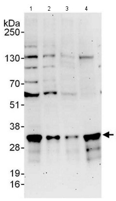 All lanes : Anti-Proteasome Inhibitor subunit 1 PI3 1 antibody (ab140527) at 0.1 µg/mlLane 1 : 293T whole cell lysate at 50 µgLane 2 : 293T whole cell lysate at 15 µgLane 3 : HeLa whole cell lysate at 50 µgLane 4 : Jurkat whole cell lysate at 50 µg