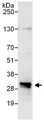 Immunoprecipitation of Proteasome Inhibitor subunit 1 PI3 1 from 293T whole cell lysate using ab140527 at 6 µg/mg lysate (1 mg for IP; 20% of IP loaded). For blotting immunoprecipitated Proteasome Inhibitor subunit 1 PI3 1, ab140527 was used at 0.4 µg/ml. Detection: chemiluminescence with an exposure time of 10 seconds.
