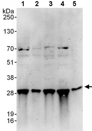 All lanes : Anti-Proteasome subunit alpha type 6 antibody (ab140443) at 0.1 µg/mlLane 1 : 293T whole cell lysate at 50 µgLane 2 : 293T whole cell lysate at 15 µgLane 3 : HeLa whole cell lysate at 50 µgLane 4 : Jurkat whole cell lysate at 50 µgLane 5 : NIH 3T3 whole cell lysate at 50 µgdeveloped using the ECL technique