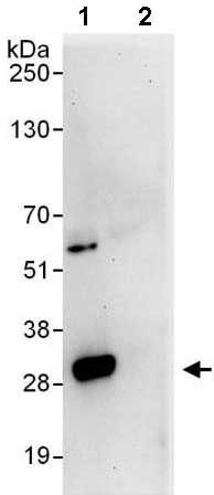 Detection of Proteasome subunit alpha type 6 in Immunoprecipitates of 293T whole cell lysates (1 mg for IP, 20% of IP loaded) using ab140443 at 6 µg/mg lysate for IP and 1µg/ml for WB detection (Lane 1). Lane 2 represents control IgG IP. Detection: Chemiluminescence with an exposure time of 30 seconds.