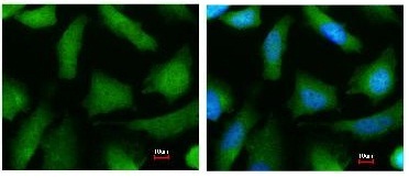 ab97562, at a 1/200 dilution, staining Proteasome subunit alpha type 6 in paraformaldehyde-fixed HeLa cells by Immunofluorescence analysis. Right image is merged to a DNA probe.