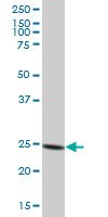 Anti-Proteasome subunit alpha type 6 antibody (ab167312) at 1 µg/ml + Human liver lysate at 50 µg