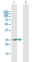 All lanes : Anti-Proteasome subunit alpha type 6 antibody (ab167312) at 1 µg/mlLane 1 : Proteasome subunit alpha type 6-transfected 293T cell line lysateLane 2 : Non-transfected lysateLysates/proteins at 15 µl per lane.