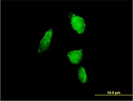 Immunofluorescent analysis of HeLa cells labeling Proteasome subunit alpha type 6 with ab167312 at 10 µg/ml.
