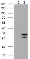 All lanes : Anti-Proteasome subunit alpha type 6 antibody [4C9] (ab128490) at 1/500 dilutionLane 1 : HEK293T cells transfected with pCMV6-ENTRY control cDNALane 2 : HEK293T cells transfected with pCMV6-ENTRY Proteasome subunit alpha type 6 cDNALysates/proteins at 5 µg per lane.