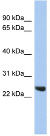 Anti-Proteasome subunit beta type 2 antibody (ab90510) at 1 µg/ml + HeLa cell lysate at 10 µgSecondaryanti-Rabbit IgG HRP at 1/50000 dilution
