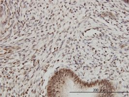Proteasome subunit beta type 2 antibody (ab55627) used in immunohistochemistry at 3ug/ml on formalin fixed and paraffin embedded human endometrium.