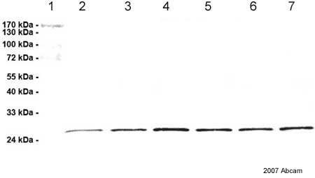 Lane 1 :  Protein Marker IVLanes 2 - 7 :  Anti-Proteasome subunit beta type 2 antibody [MCP165] (ab22650) at 1/1000 dilutionLane 1 : Protein Marker IVLane 2 : Protein extract from ciliary body of diseased human donor at 2 µgLane 3 : Protein extract from ciliary body of normal human donor at 2 µgLane 4 : Protein extract from ciliary body of diseased human donor at 2 µgLane 5 : Protein extract from ciliary body of normal human donor at 2 µgLane 6 : Protein extract from ciliary body of diseased human donor at 2 µgLane 7 : Protein extract from ciliary body of normal human donor at 2 µgSecondaryLanes 2 - 7 : HRP conjugated goat anti mouse antibodyObserved band size : 27 kDa (why is the actual band size different from the predicted?)This image is courtesy of an Abreview submitted by Dr Matthias ZenkelSee Abreview