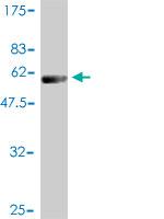 Western blot against tagged recombinant protein immunogen using ab55628 Proteasome subunit beta type 4 antibody at 1ug/ml. 