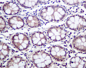 Immunohistochemical analysis of paraffin-embedded Human colon tissue labelling Proteasome subunit beta type 4 with ab137067 at 1/100 dilution.