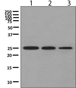 All lanes : Anti-Proteasome subunit beta type 4 antibody [EPR9397] (ab137087) at 1/1000 dilutionLane 1 : 293T cell lysatesLane 2 : HeLa cell lysatesLane 3 : HepG2 cell lysatesLysates/proteins at 10 µg per lane.Secondarygoat anti-rabbit HRP at 1/200 dilution