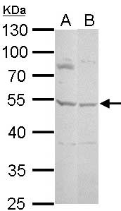 Anti-Protein C inhibitor antibody (ab154275) at 1/3000 dilution + H1299 whole cell lysate at 30 µg