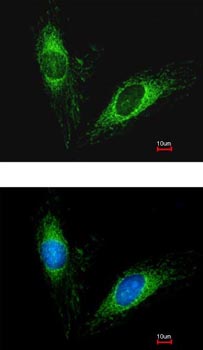 Immunofluorescence analysis of methanol-fixed HeLa, labeling Anti-Protein C inhibitor with ab154275 at 1/200 dilution.