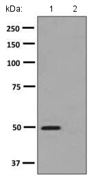 All lanes : Anti-Protein Kinase A regulatory subunit I alpha (phospho S77) antibody [EPMAYR1] (ab139682) at 1/1000 dilutionLane 1 : Fetal heart lysateLane 2 : Fetal heart lysate treated with Alkaline Phosphatase.Lysates/proteins at 10 µg per lane.SecondaryHRP labelled goat anti-rabbit at 1/2000 dilution