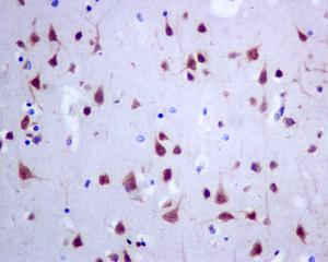 Immunohistochemical analysis of paraffin-embedded Human brain tissue labeling Protein Kinase A regulatory subunit I alpha, with ab139695 at 1/50 dilution.