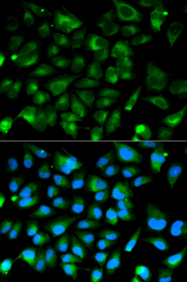 Immunocytochemistry/Immunofluorescence analysis of HeLa cells using ab180825. Blue DAPI for nuclear staining.