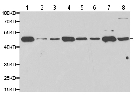 All lanes : Anti-Protein Kinase A regulatory subunit I alpha antibody - N-terminal (ab180825) at 1/500 dilutionLane 1 : HeLa cell lysateLane 2 : CEM cell lysateLane 3 : A549 cell lysateLane 4 : SW480 cell lysateLane 5 : PC3 cell lysateLane 6 : V251 cell lysateLane 7 : HCT116 cell lysateLane 8 : Mouse heart tissue lysate
