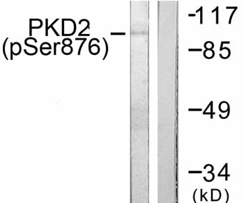 All lanes : Anti-Protein Kinase D2 (phospho S876) antibody (ab59417) at 1/500 dilutionLane 1 : extracts from NIH/3T3cells treated with PMA (250ng/ml, 15mins)Lane 2 : extracts from NIH/3T3cells treated with PMA (250ng/ml, 15mins) with blocking phosphopeptide
