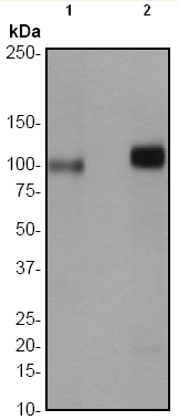All lanes : Anti-Protein Kinase D2 (phospho S876) antibody [EP1496Y] (ab51251) at 1/1000 dilutionLane 1 : HeLa cell lysate, untreatedLane 2 : HeLa cell lysate, treated with TPALysates/proteins at 10 µg per lane.SecondaryGoat anti-Rabbit HRP labeled at 1/2000 dilution