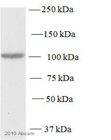 Anti-Protein Kinase D2 antibody (ab7281) at 1/500 dilution + whole cell lysate prepared from murine NIH3T3 cells at 25 µgSecondaryDonkey anti-rabbit HRP at 1/5000 dilutiondeveloped using the ECL techniqueExposure time : 15 minutesImage courtesy of an anonymous Abreview.