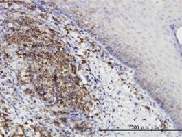 Protein Kinase D2 antibody (ab57114) used in immunohistochemistry at 1ug/ml on formalin fixed and paraffin embedded human tonsil.