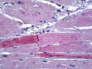 ab118639 at 10 µg/ml staining Protein Kinase D2 in Formalin-Fixed, Paraffin-Embedded Human Heart tissue by Immunohistochemistry.