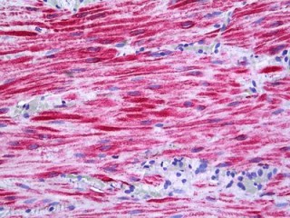 ab118639 at 10 µg/ml staining Protein Kinase D2 in Formalin-Fixed, Paraffin-Embedded Human Intestine tissue by Immunohistochemistry.