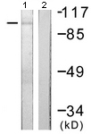 All lanes : Anti-Protein Kinase D2 antibody (ab118639) at 1/500 dilutionLane 1 : NIH 3T3 cell extract, treated with PMA 250ng/ml for 15 mins.Lane 2 : NIH 3T3 cell extract, treated with PMA 250ng/ml for 15 mins with synthesized peptide