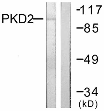 All lanes : Anti-Protein Kinase D2 antibody (ab59372) at 1/500 dilutionLane 1 : Extracts from NIH/3T3 cells, treated with PMA (250ng/ml, 15mins)Lane 2 : Extracts from NIH/3T3 cells, treated with PMA (250ng/ml, 15mins) with immunizing phosphopeptide