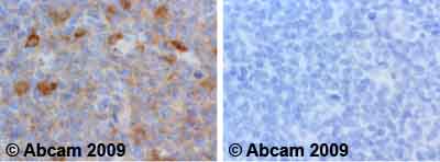 Ab59372 staining human normal tonsil. Staining is localised to cytoplasmic compartment.Left panel: with primary antibody at 1 ug/ml. Right panel: isotype control.Sections were stained using an automated system DAKO Autostainer Plus , at room temperature. Sections were rehydrated and antigen retrieved with the Dako 3-in-1 antigen retrieval buffers EDTA pH 9.0 in a DAKO PT Link. Slides were peroxidase blocked in 3% H2O2 in methanol for 10 minutes. They were then blocked with Dako Protein block for 10 minutes (containing casein 0.25% in PBS) then incubated with primary antibody for 20 minutes and detected with Dako Envision Flex amplification kit for 30 minutes. Colorimetric detection was completed with diaminobenzidine for 5 minutes. Slides were counterstained with Haematoxylin and coverslipped under DePeX. Please note that for manual staining we recommend to optimize the primary antibody concentration and incubation time (overnight incubation), and amplification may be required.