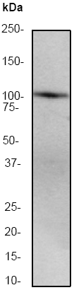 Anti-Protein Kinase D2 antibody [EP1495Y] (ab51250) at 1/500 dilution + HeLa cell lysate at 10 µgSecondaryGoat anti-rabbit HRP labeled at 1/2000 dilution