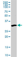 Anti-Protein phosphatase 1 inhibitor 3C antibody (ab103300) at 5 µg/ml + Mouse kidney tissue lysate at 50 µg