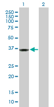 All lanes : Anti-Protein phosphatase 1 inhibitor 3C antibody (ab103300) at 5 µg/mlLane 1 : Protein phosphatase 1 inhibitor 3C transfected 293T cell lysateLane 2 : Non-transfected 293T cell lysateLysates/proteins at 25 µg per lane.
