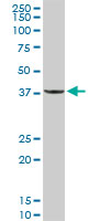 Anti-Protein phosphatase 1 inhibitor 3C antibody (ab103299) at 5 µg/ml + Human liver tissue lysate at 50 µg