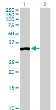 All lanes : Anti-Protein phosphatase 1 inhibitor 3C antibody (ab103299) at 5 µg/mlLane 1 : Protein phosphatase 1 inhibitor 3C transfected 293T cell lysateLane 2 : Non-transfected 293T cell lysateLysates/proteins at 25 µg per lane.
