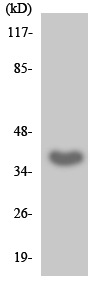 Anti-Protein phosphatase 1 inhibitor 3C antibody (ab137959) at 1/500 dilution + HeLa cell lysate at 30 µg