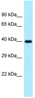 Anti-Protein phosphatase 1 inhibitor 3C antibody (ab123016) at 1 µg/ml + 293T cell lysate at 10 µgSecondaryanti-Rabbit IgG HRP