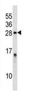 Anti-Protein phosphatase 1 inhibitor subunit 2 antibody (ab124225) at 1/100 dilution + HeLa cell lysate at 35 µg