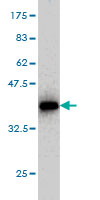 Western blot against tagged recombinant protein immunogen using ab58149 Protein phosphatase 1 inhibitor subunit 2 antibody at 1ug/ml.