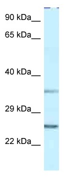 Anti-Protein phosphatase 1 inhibitor subunit 2 antibody (ab116047) at 1 µg/ml + THP-1 cell lysate at 10 µg