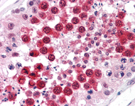 ab111084, at 5µg/ml, staining Protein phosphatase 1 inhibitor subunit 2 in formalin-fixed, paraffin-embedded Human testis tissue by Immunohistochemistry.