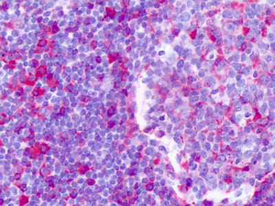 Immunohistochemistry of formalin-fixed, paraffin-embedded Human Tonsil tissue labelling Proteinase Activated Receptor 3 with ab150511 at 2.8 µg/ml.