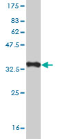 Western blot against tagged recombinant protein immunogen using ab57594 Protocadherin beta 12 antibody at 1ug/ml.