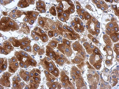Immunohistochemical analysis of paraffin-embedded Human hepatoma tissue labeling Protor-1 with ab154684 at 1/500 dilution.
