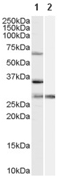 All lanes : Anti-PRPF31 antibody (ab58588) at 1 µg/mlLane 1 : HeLa cell lysate (35µg protein in RIPA buffer) without blocking with the immunizing peptideLane 2 : HeLa cell lysate (35µg protein in RIPA buffer) with blocking with the immunizing peptide
