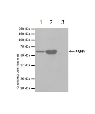 PRPF4 was immunoprecipitated from 1mg of HeLa (Human epithelial cells from cervix adenocarcinoma) whole cell lysate with ab201684 at 1/40 dilution. Western blot was performed from the immunoprecipitate using ab201684 at 1/1000 dilution. VeriBlot for IP secondary antibody (HRP) (ab131366) was used as secondary antibody at 1/1500 dilution.Lane 1: HeLa whole cell lysate 10 µg (Input). Lane 2: ab201684 IP in HeLa whole cell lysate. Lane 3: Rabbit monoclonal IgG (ab172730) instead of ab201684 in HeLa whole cell lysate.Blocking and dilution buffer and concentration: 5% NFDM/TBST.Exposure time: 5 seconds.