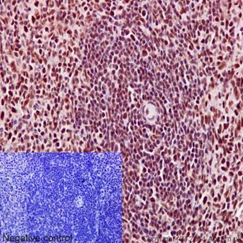 Immunohistochemical analysis of paraffin-embedded, rat spleen tissue labeling PRPF8 with ab190347 at a 1/100 dilution. Counter stained with hematoxylin. Negative control also shown.